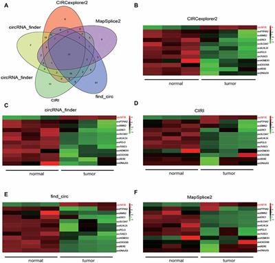 NFIX Circular RNA Promotes Glioma Progression by Regulating miR-34a-5p via Notch Signaling Pathway